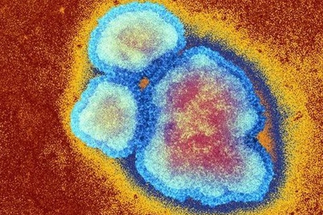 Αναζωπύρωση της ιλαράς στην Ελλάδα -100 περιστατικά σε 4 μήνες