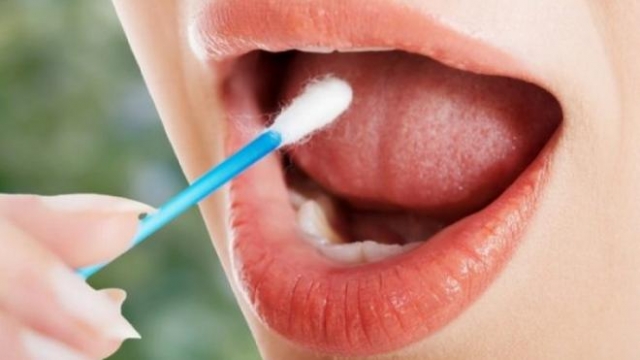 Κρούουν τον κώδωνα του κινδύνου οι οδοντίατροι για τον καρκίνο του στόματος