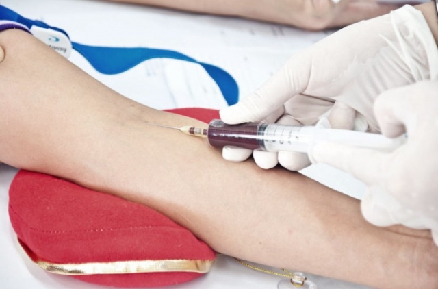 Τεστ αίματος αποκαλύπτει τι ώρα είναι μέσα στο σώμα του ανθρώπου